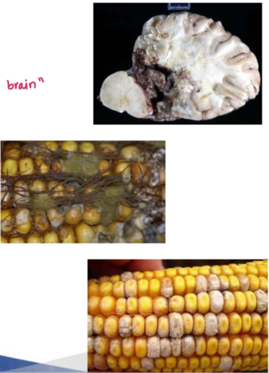 <p>what is the pathology of leukoencephalomalacia aka moldy corn disease</p>