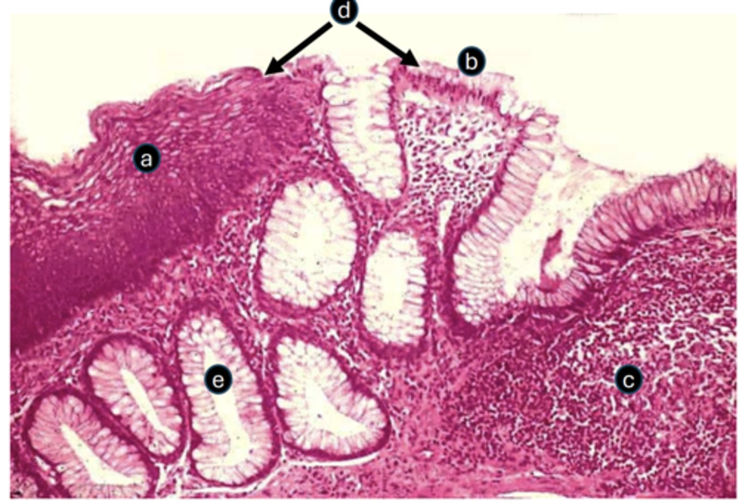 <p>D) ID the labeled structure</p>