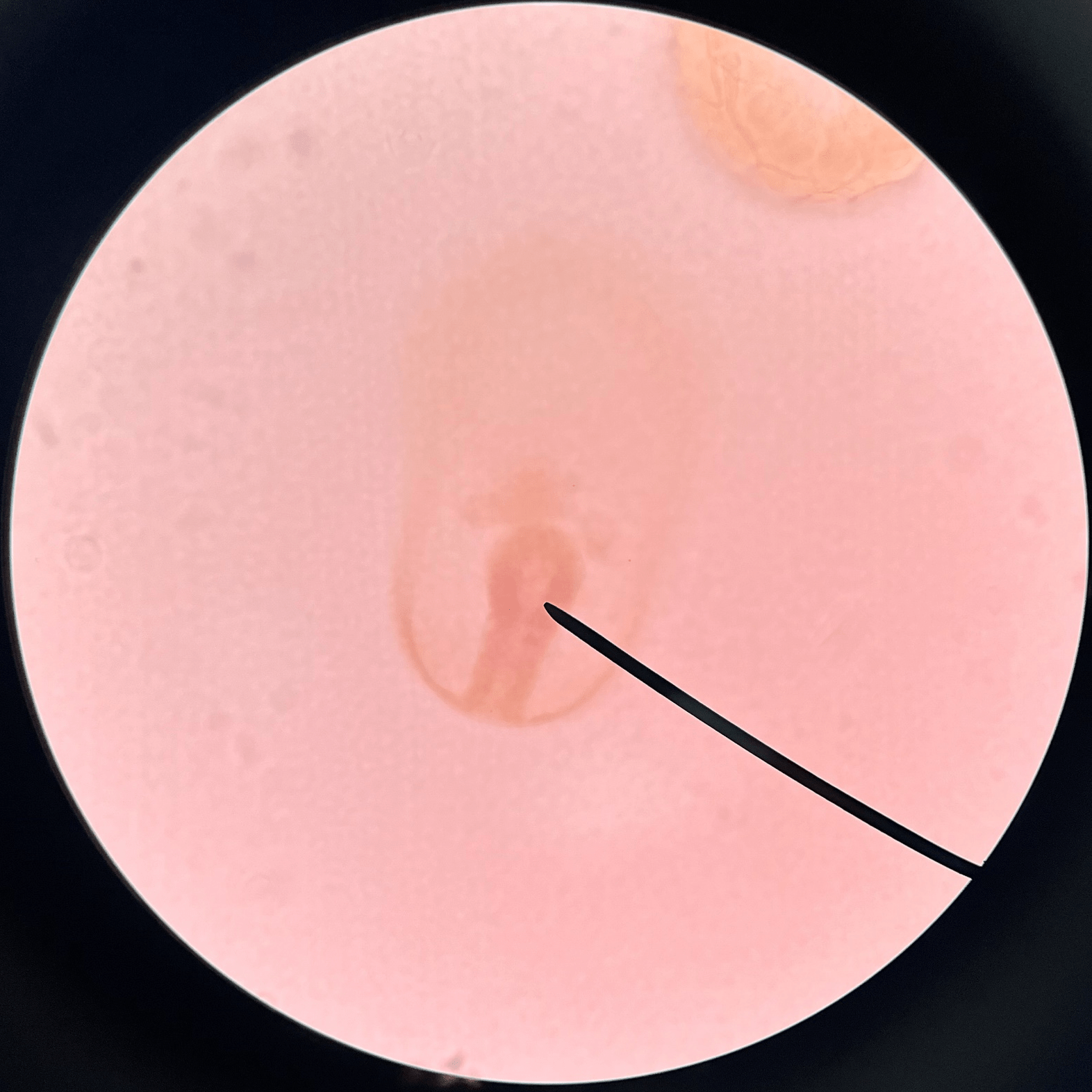 • Slide histology of starfish development.

• The blastocyst has nearly completed gastrulation.
