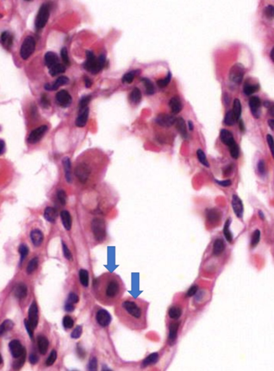 <p>Identify these unattached cells in this alveolus</p>
