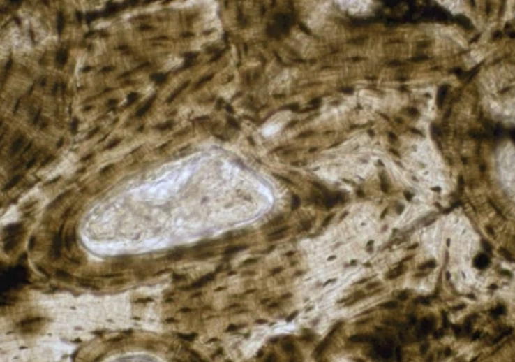 <p>What type of bone tissue does the picture depict?</p>