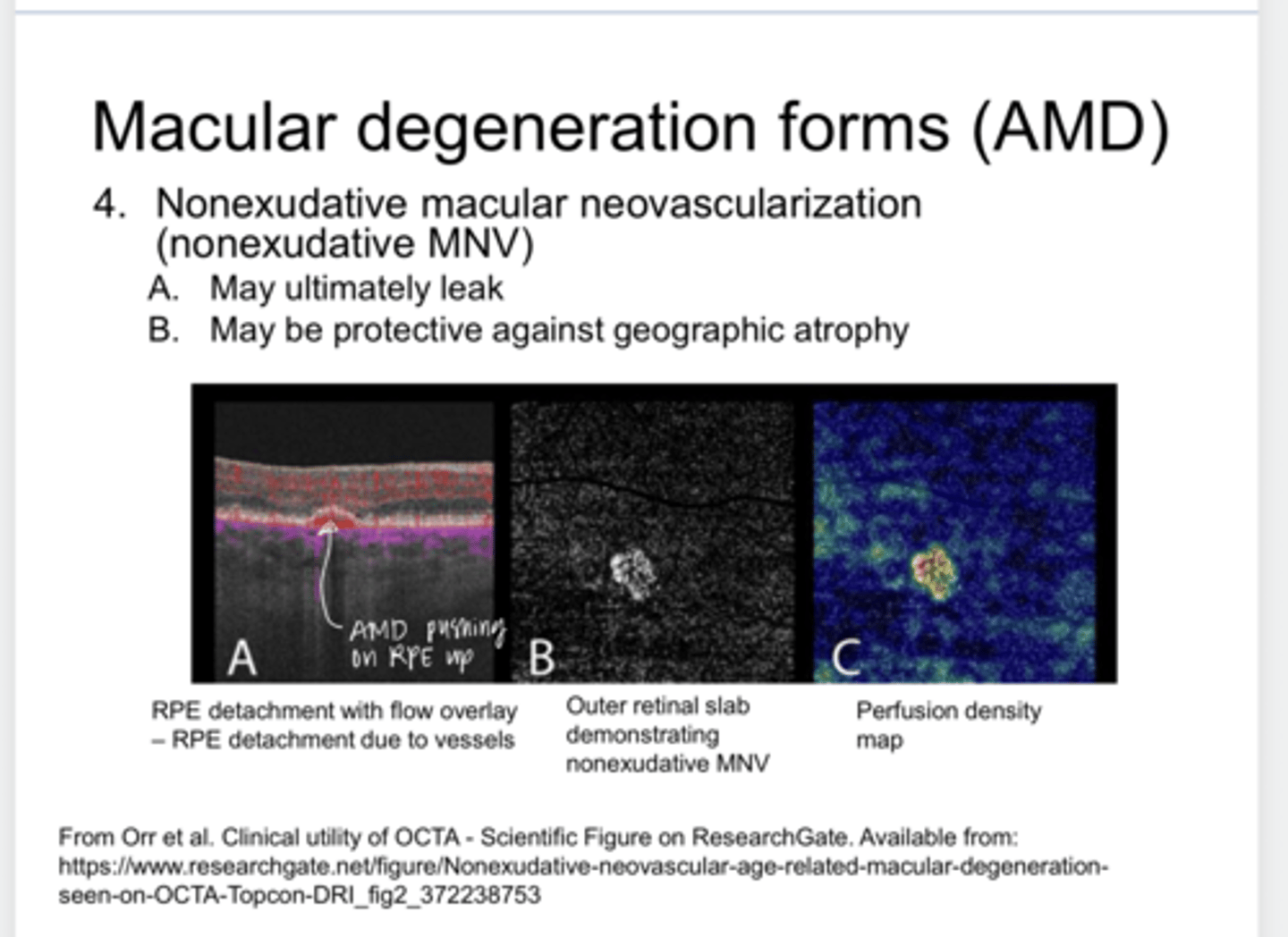 <p>Why is non-exudative macular neovascularization (nonexudative MNV) protective against geographic atrophy?</p>
