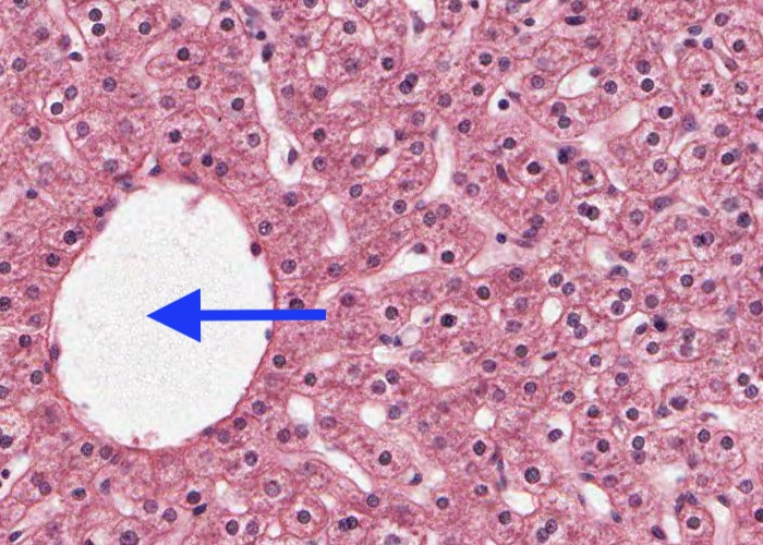 <p>The circular structure whos elumen is arrowed (x10) is a?</p>