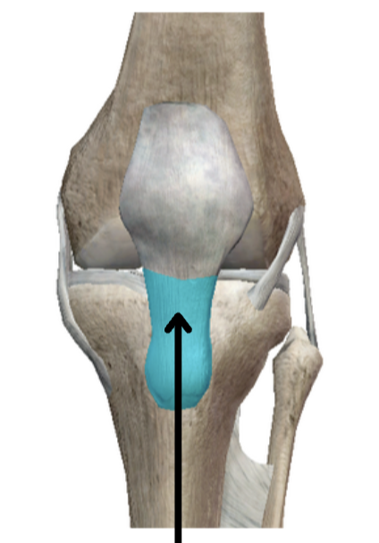 <p>Name the ligament/tendon</p>