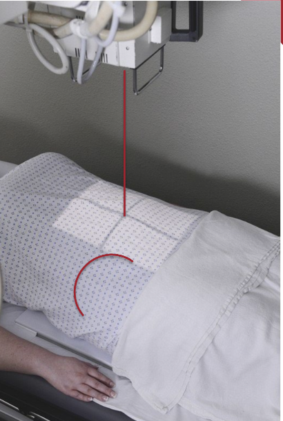 <ul><li><p>Center IR at level of iliac crests</p></li><li><p>Ensure both sides of abdomen are equal distances from edge of IR</p></li><li><p>May need to place something under parts of IR to ensure IR is perpendicular to CR</p></li></ul><p></p>