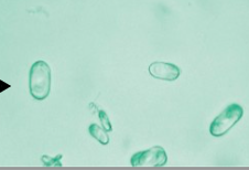 <p>dumbbell or oval shape, can be confused with RBC → use polarizer</p>