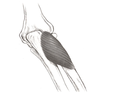 <p><strong>Origin</strong>: lateral humerus, superior to epicondyle</p><p><strong>Insertion</strong>: lateral, posterior, and anterior surface of proximal 1/3 of radius</p><p><strong>Action</strong>: supinates forearm</p>