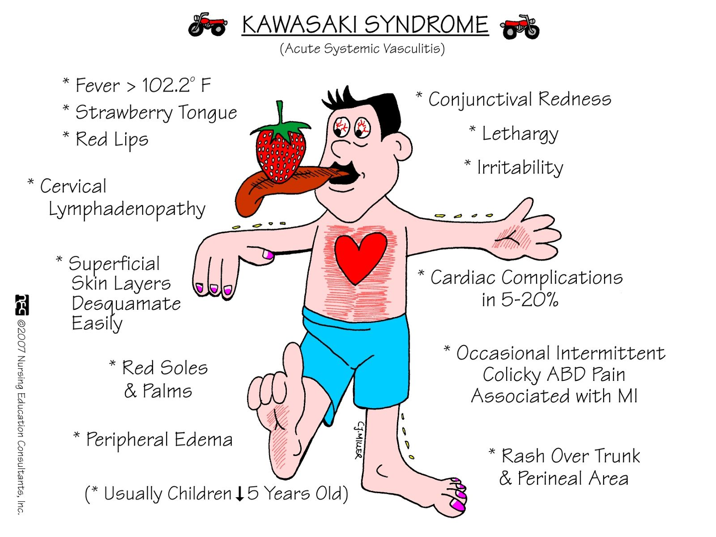 <p>Prognosis for Kawasaki Disease</p>