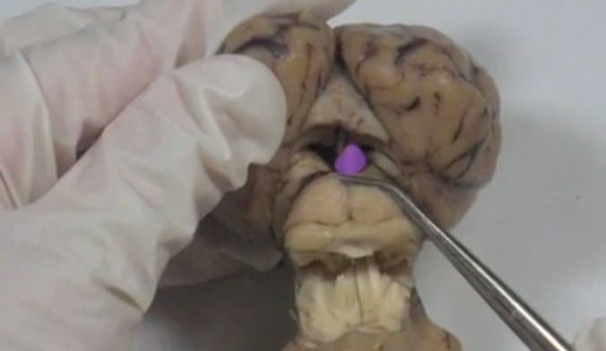 <p>Pituitary gland </p>