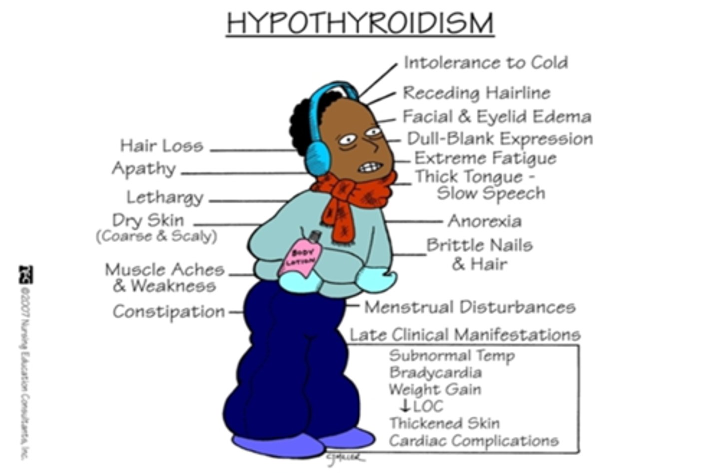 <p>hypothyroidism</p>