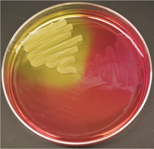 <p>Selective &amp; Differential</p><p>Selects for G+, against G- </p><p>— selecting agent: 7.5% NaCl </p><p>— G- can grow in high salt concentrations </p><p>— differential agent: mannitol and phenol red</p><p>mannitol fermentation produces acid which changes the phenol red to a yellow color </p><p>important for differentiating Straphs </p>
