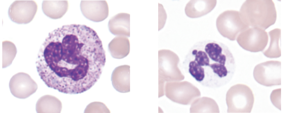 <p>what image (left or right) shows the cytoplasmic abnormality associated with the following:</p><ul><li><p>absence of granules </p></li><li><p>degranulation </p></li><li><p>hypo- or -agranular</p></li></ul><p></p>