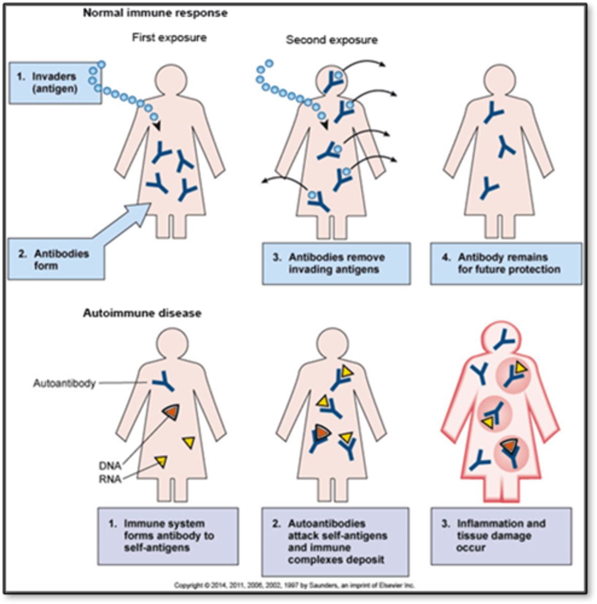 <p>- Overreaction and confusion of immune system</p><p>- Development of autoantibodies, don't recognize our own tissue</p><p>- Effects: Inflammation, tissue damage</p><p>- Immune system can't distinguish between self and non self</p><p>- More common in women</p><p>- Genetic predisposition, something in the environment could activate it</p><p>- Type 1 diabetes: Born with tendency then something triggers it along the way; ex. Puberty, viral triggers</p>