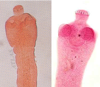 Scolex of ____________. State the number of suckers and the ___________ that are clearly visible.