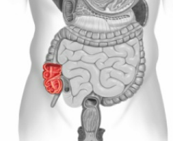 <p>Following ingestion of infective eggs the larvae hatch in the small intestine establish themselves in the colon, usually in the ________.</p>