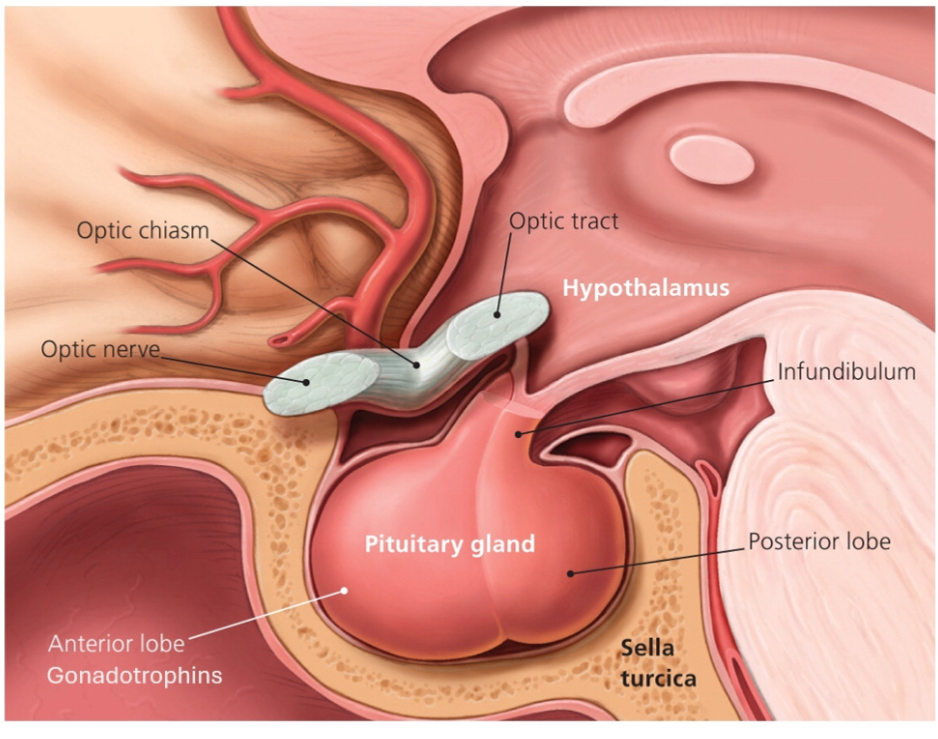 <p>The HPG axis (Hypothalamic–Pituitary–Gonadal axis) is a top-down hormonal control system that regulates sexual development, puberty, gamete production, and sex steroid levels through hierarchical signalling and negative feedback.</p><p></p><p><strong>Step-by-step definition</strong></p><ol><li><p>Hypothalamus releases GnRH in a pulsatile manner.</p></li><li><p>Pituitary gland responds to GnRH by releasing LH and FSH.</p></li><li><p>Gonads (testes or ovaries) respond to LH/FSH by:</p><ul><li><p>Producing sex steroids (testosterone, oestrogen, progesterone)</p></li><li><p>Producing gametes (sperm or oocytes)</p></li></ul><p></p></li><li><p>Sex steroids feed back negatively to the hypothalamus and pituitary to regulate output.</p></li></ol><p></p><p>Why pulsatile GnRH matters:</p><p>Continuous GnRH would switch the system off; pulses keep the axis active and tunable.</p><p></p><p></p>