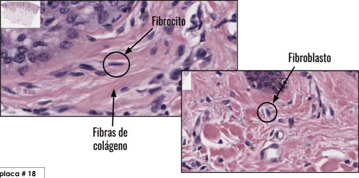 <p>Fibroblasto y fibrocitos</p>