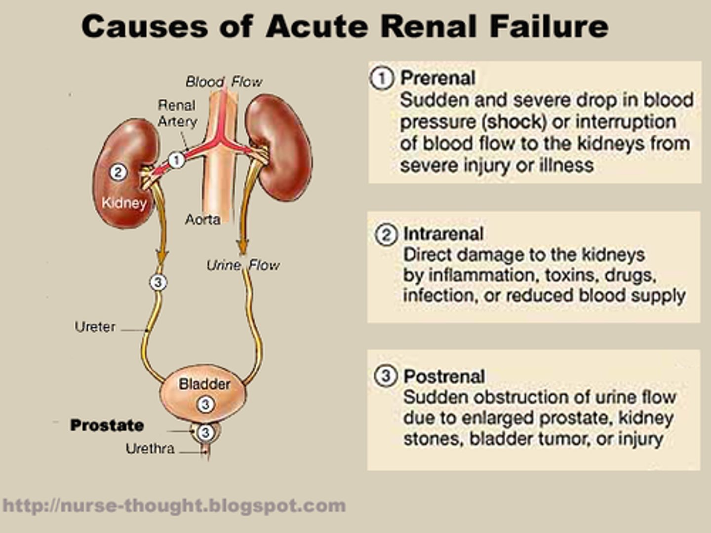 <p>- acute renal failure!!</p><p>- patient will present with high K+, even though hyperglycemic pts usually present with low K+)</p>