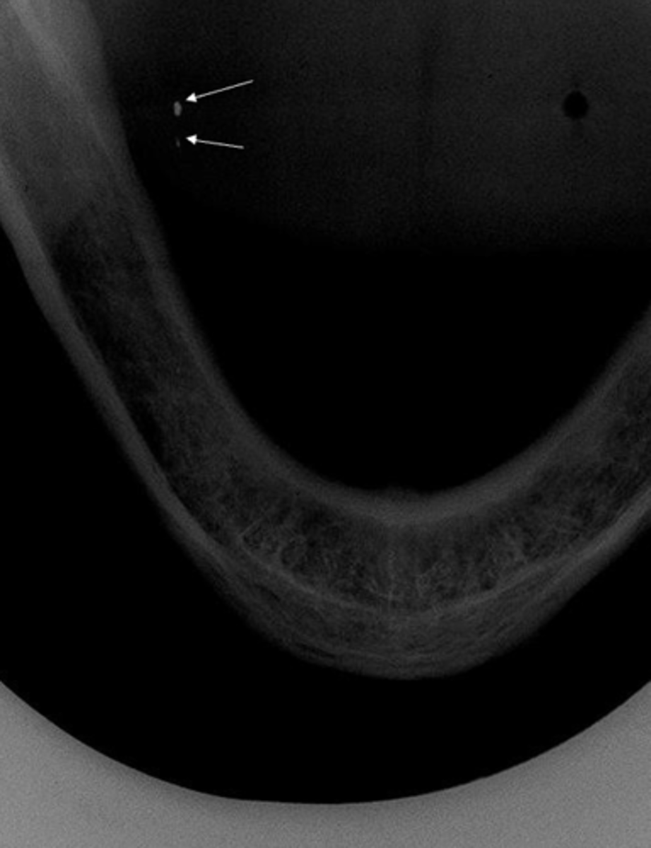 <p>What are the arrows pointing to?</p>