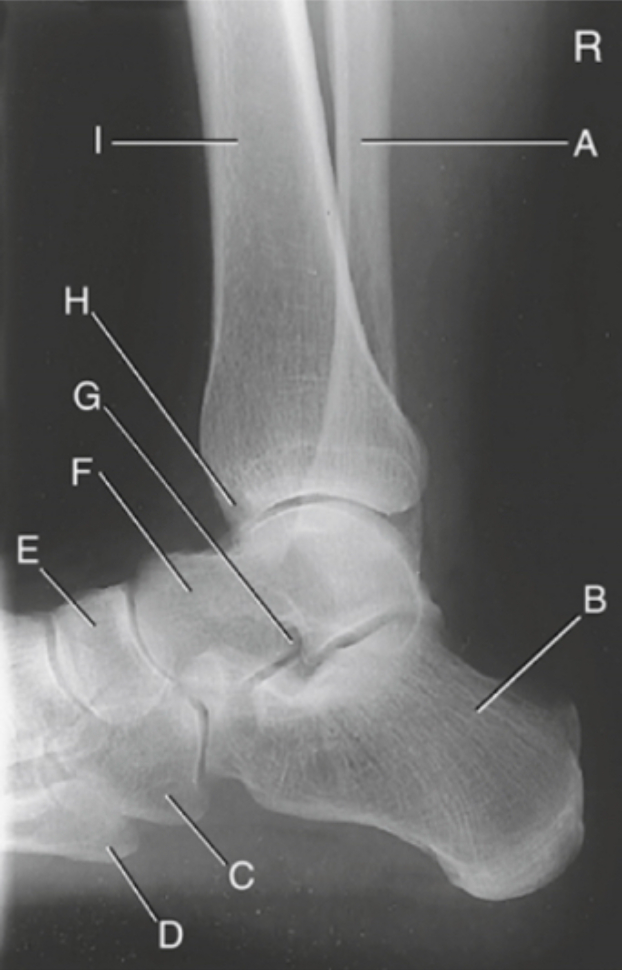 <p>H is:</p>