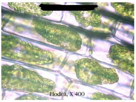 <p>Which tonicity condition do these Elodea cells represent?</p>