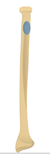 <p>What part of the radius is this?</p>