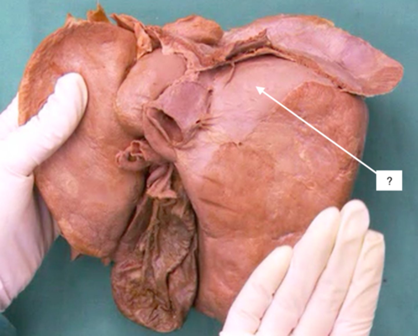 <p>not covered by peritoneum</p>