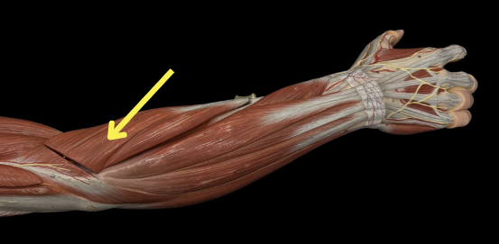 term image
