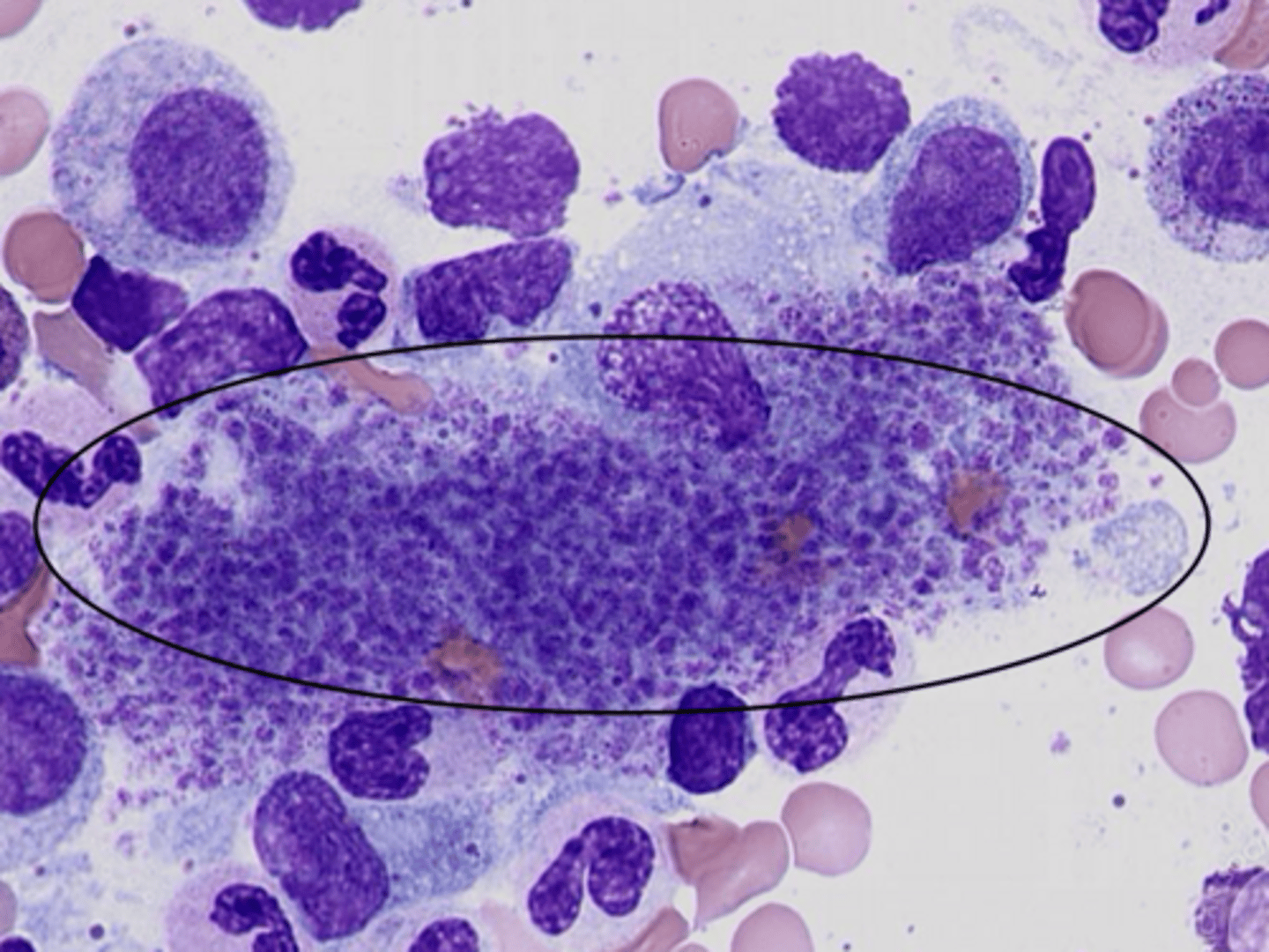 <p>What are some things that could cause pseudothrombocytopeina?</p>