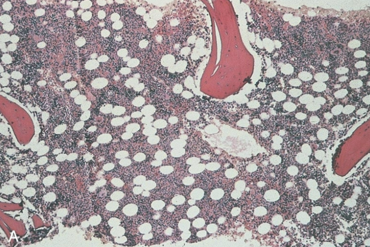 <p>classify the cellularity. include ratio.</p>
