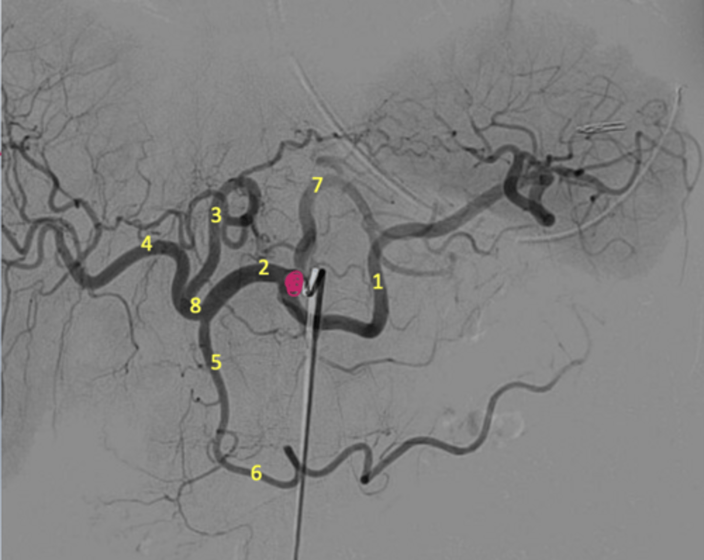 <p>Label the radiograph</p>