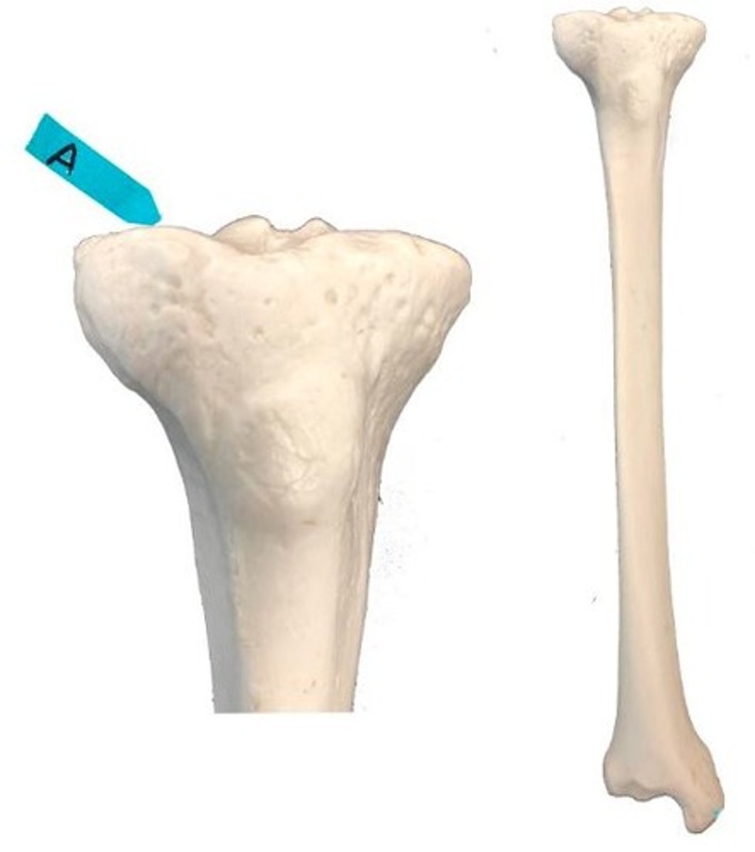<p>Identify this bone marking.</p>