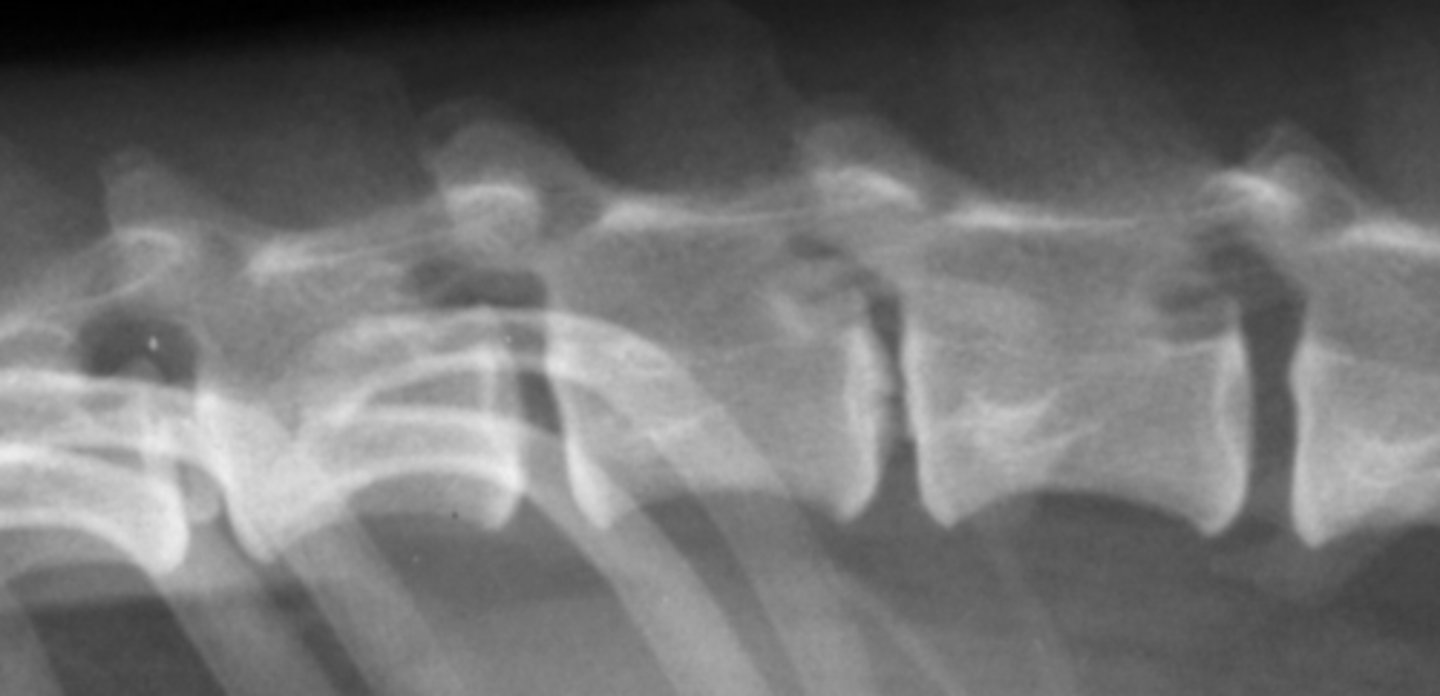 <p>Evaluate disc spaces/size, foramina, fractures, and aggressive bone lesions</p>