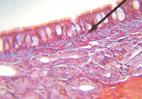 <p>what type of tissue is this </p>