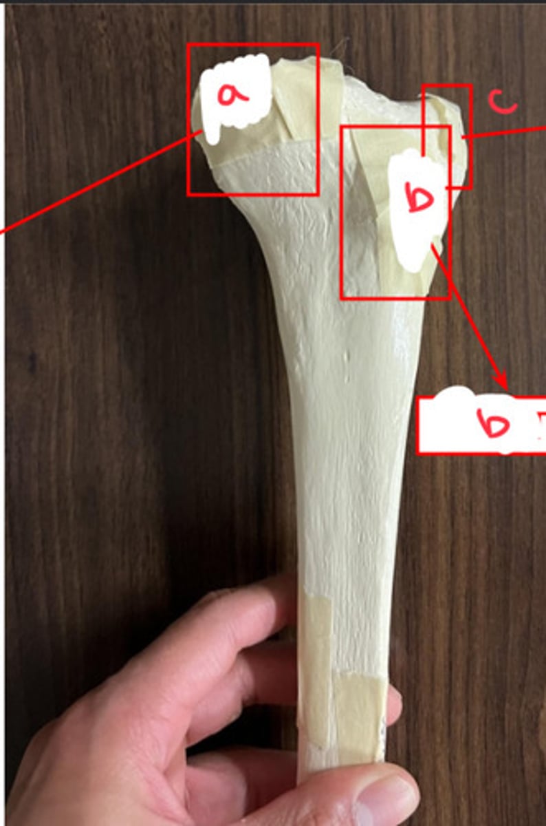 <p>what structure is labeled by c?</p>