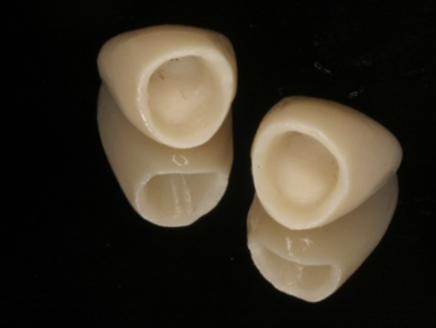 <p>What type of crown is shown?</p>