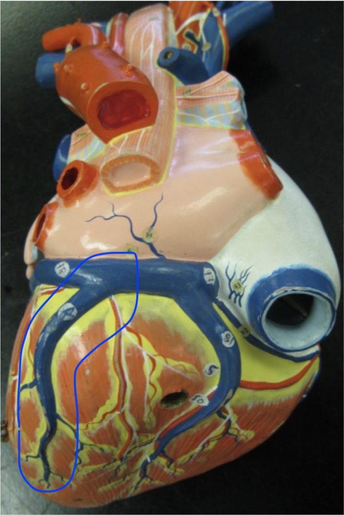 <p>blue vein in the back left </p>