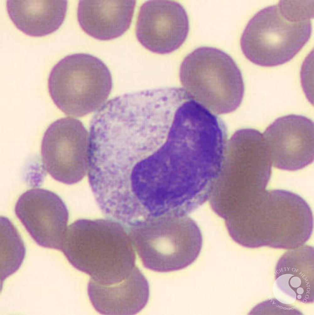 <ul><li><p>size: 10-15 um</p></li><li><p>N:C ratio is 1:1, nucleus is kidney bean-shaped, chromatin is patchy</p></li><li><p>cytoplasm is pale-blue to tan with granules</p></li><li><p>CD45, CD33, CD13, CD15, CD11</p></li></ul><p></p>