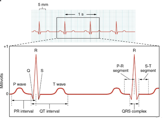 <p>the net sum of depolarisation and repolarisation of all myocardial structures. </p>