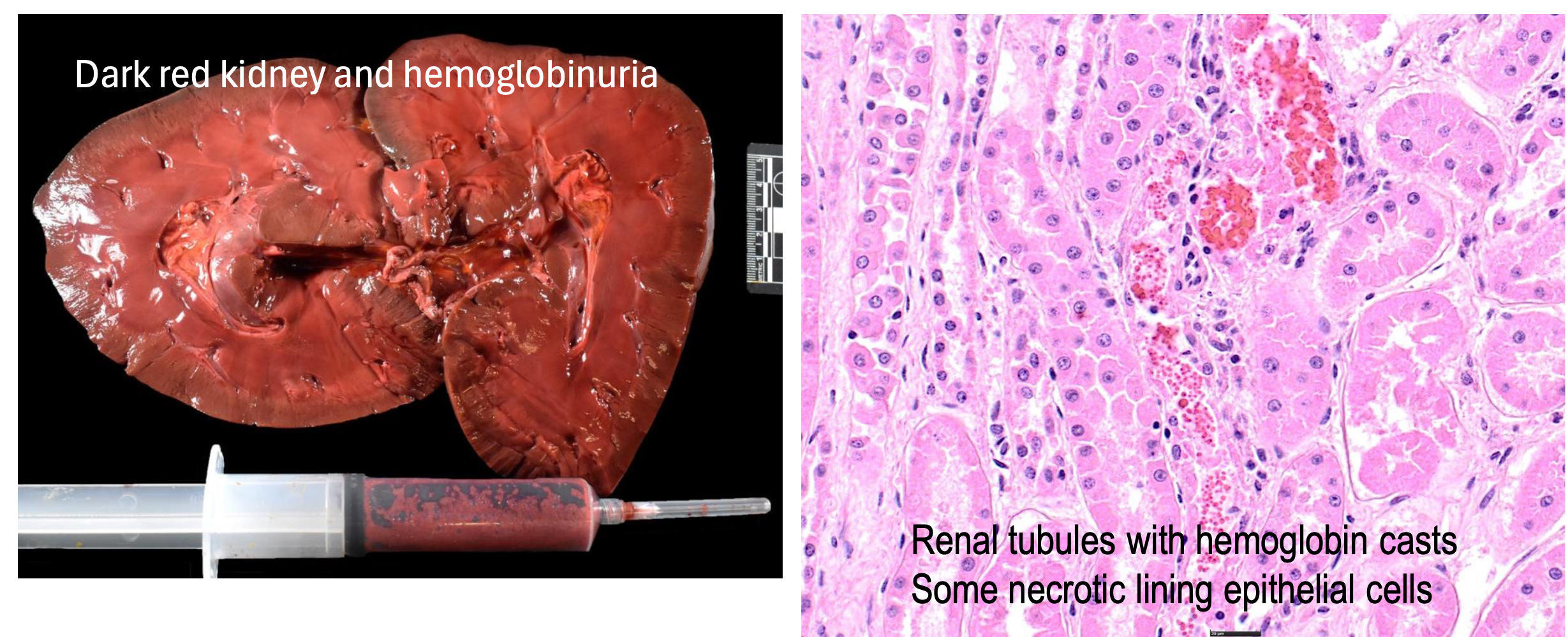 <p>within 24 hours: lethargy, anorexia, tachycardia, tachypnea, brown discoloration to blood, red tinted serum</p><p>anemia, methemoglobinemia, hemoglobinuric nephrosis</p>