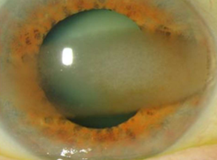 <p>What condition is this?</p>