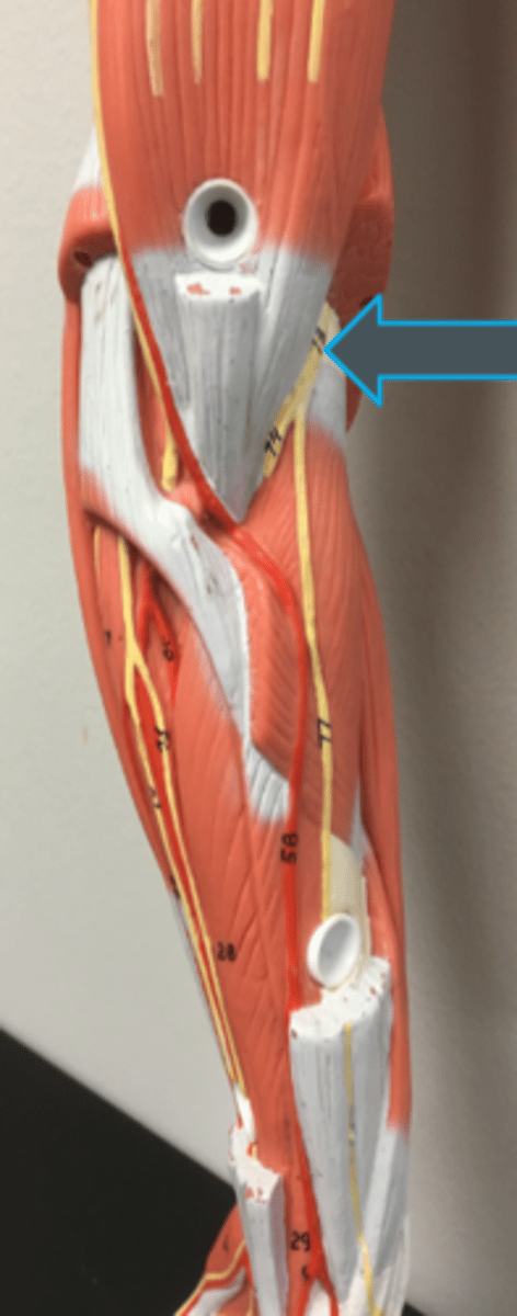 <p>innervates:<br>- triceps brachii<br>- brachioradialis<br>- supinator<br>- anconeus<br>- forearm extensors</p>