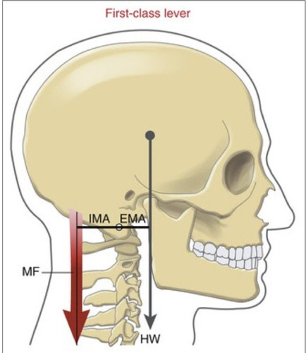 <p>Axis of rotation positioned in the middle of opposing forces</p>