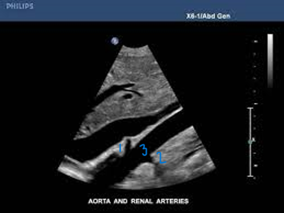 <p>In this Sagittal-Coronal plane, what is #3?</p>