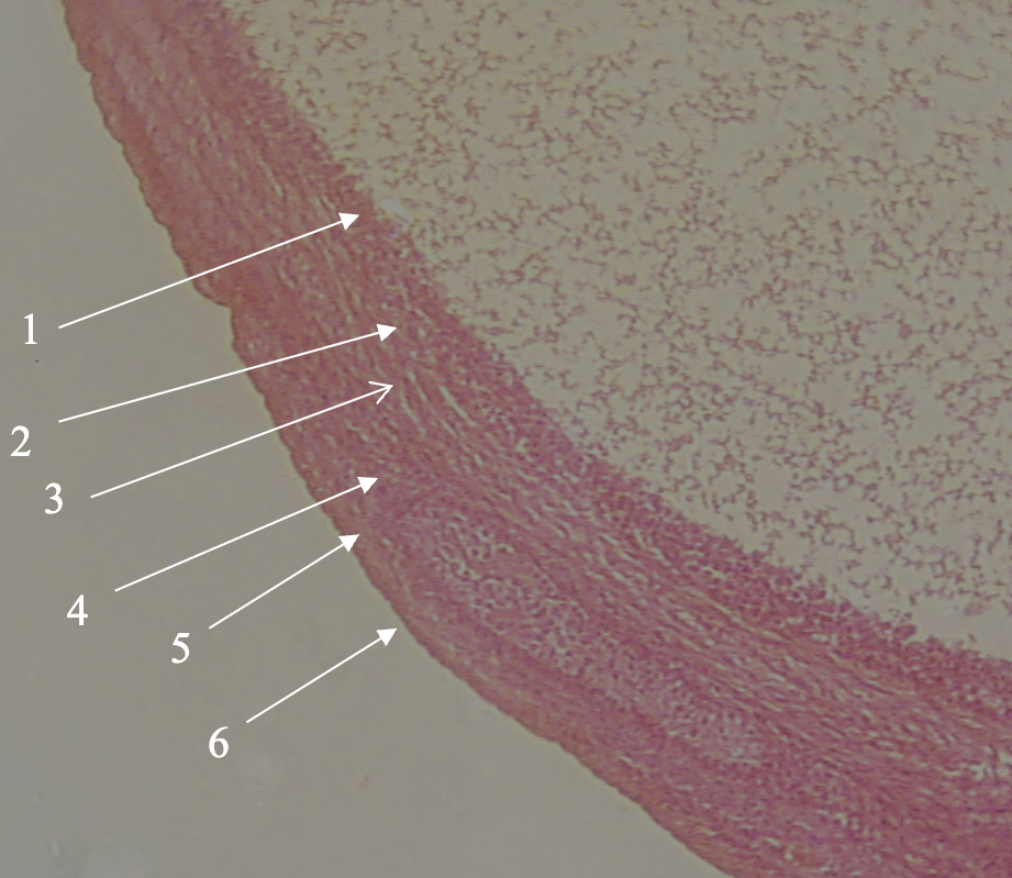 <p>What structure is being indicated by arrow #1?</p>