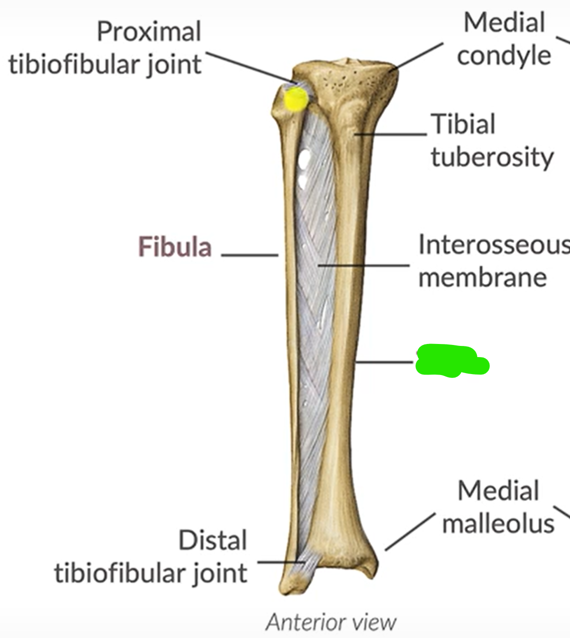 term image