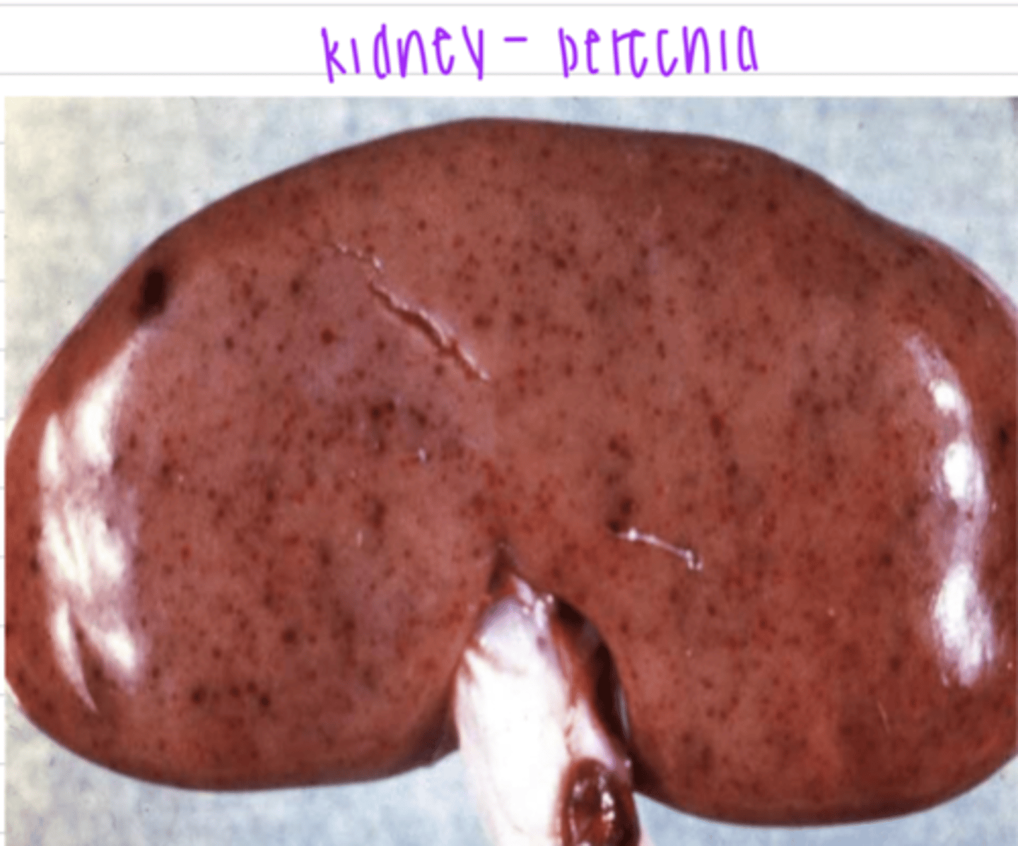 <p>small dots of blood, common in parenchymous organs</p>