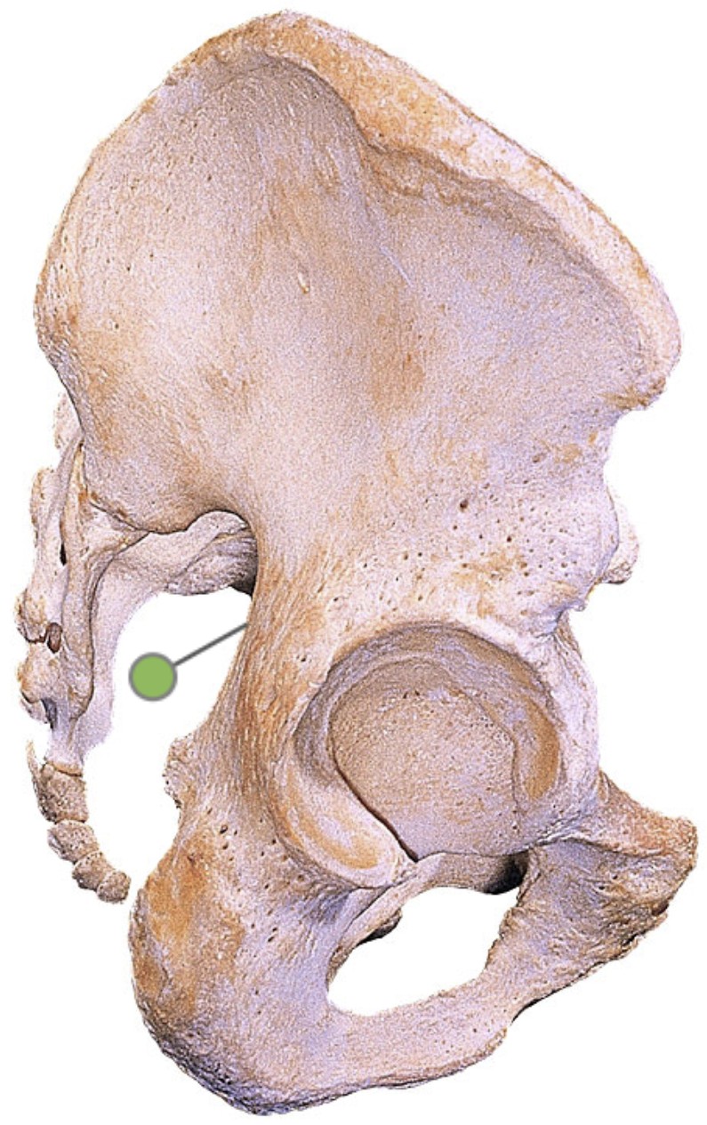 <p>Which bone landmark of the pelvic girdle is a notch on the back?</p>