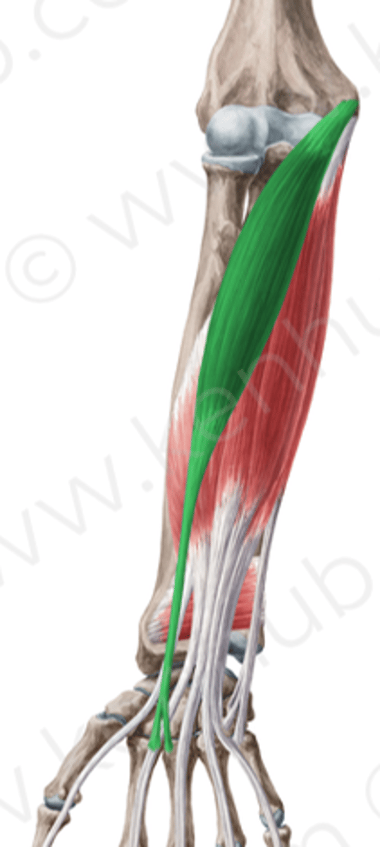 <p>What muscle is this?</p>