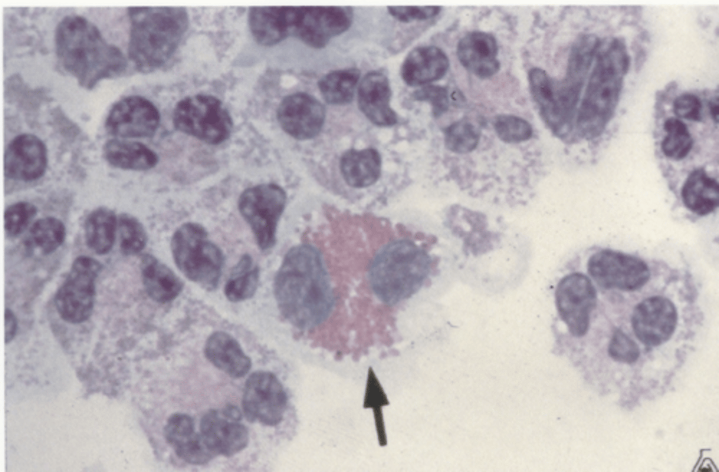 <p>Identify the cells in this body fluid</p>